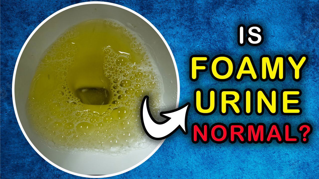 abnormal-urine-color-what-it-tells-and-doesn-t-tell-about-your-health